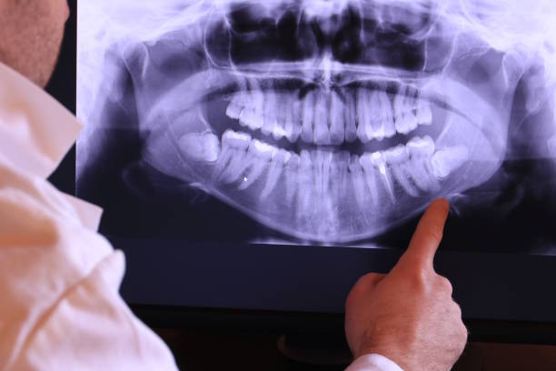 Best Emergency Dental Care for Abscessed Tooth in Crosby, TX